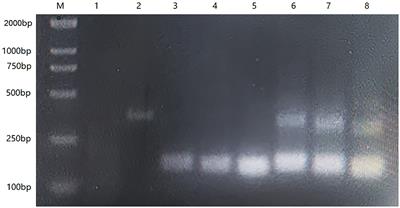 Development of a recombinase-aided amplification combined with a lateral flow dipstick assay for rapid detection of H7 subtype avian influenza virus